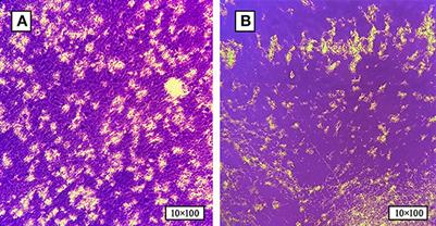 Investigation of biofilm formation and the associated genes in multidrug-resistant Salmonella pullorum in China (2018–2022)